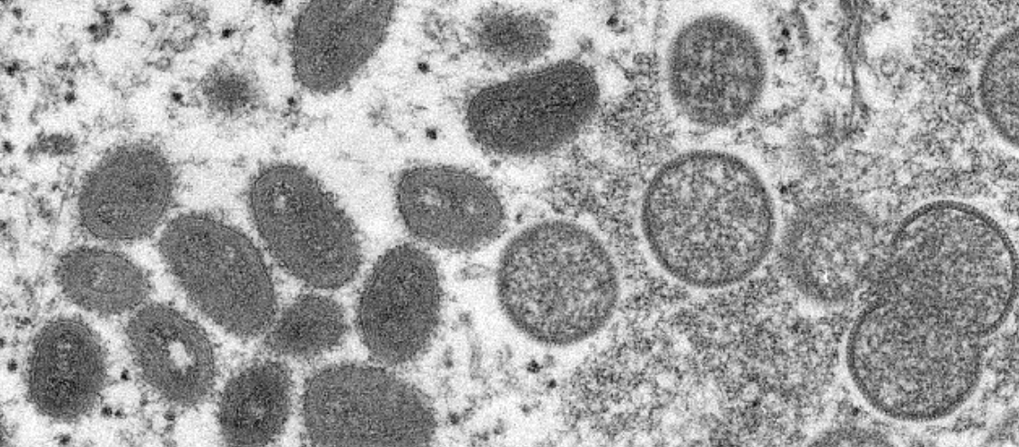 Public Health update on local monkeypox virus (MPV) cases – PUBLIC HEALTH INSIDER